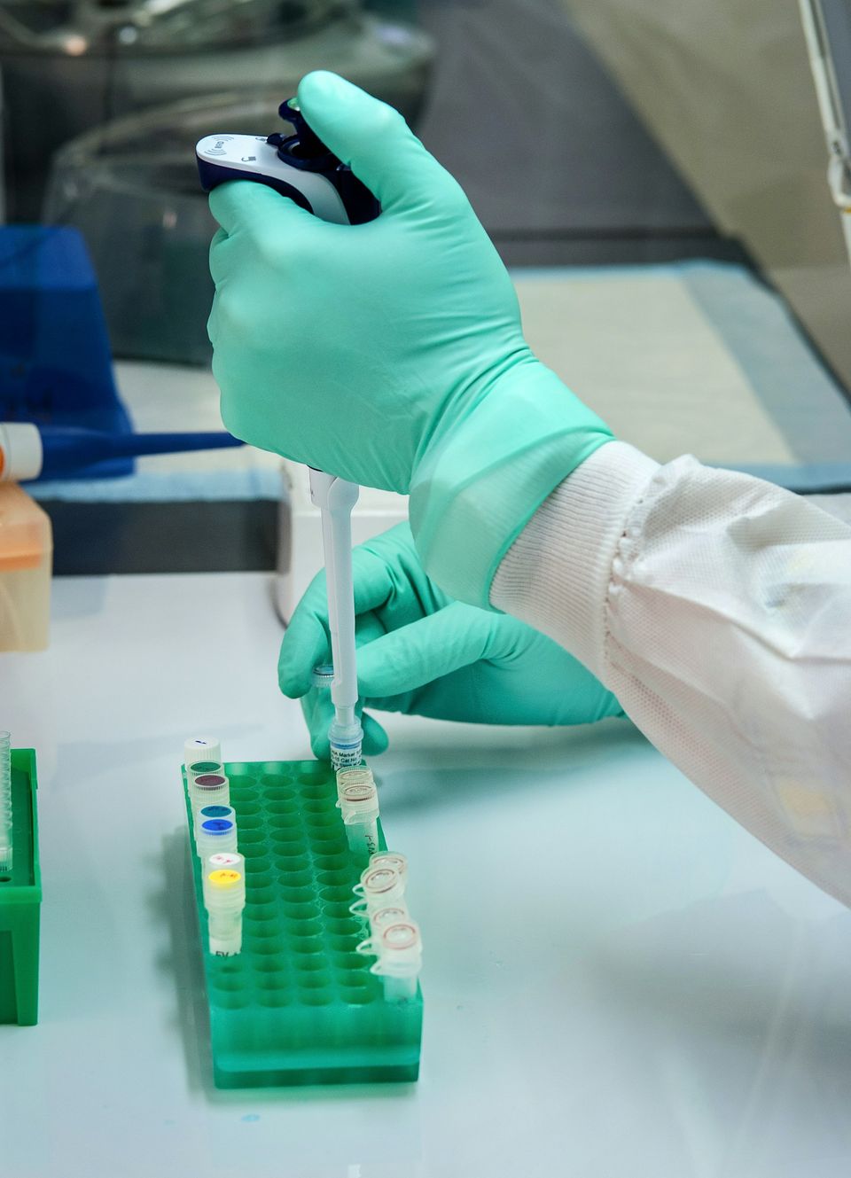 Preparations for blood group genotyping for people with sickle cell, thalassemia and rare anaemia